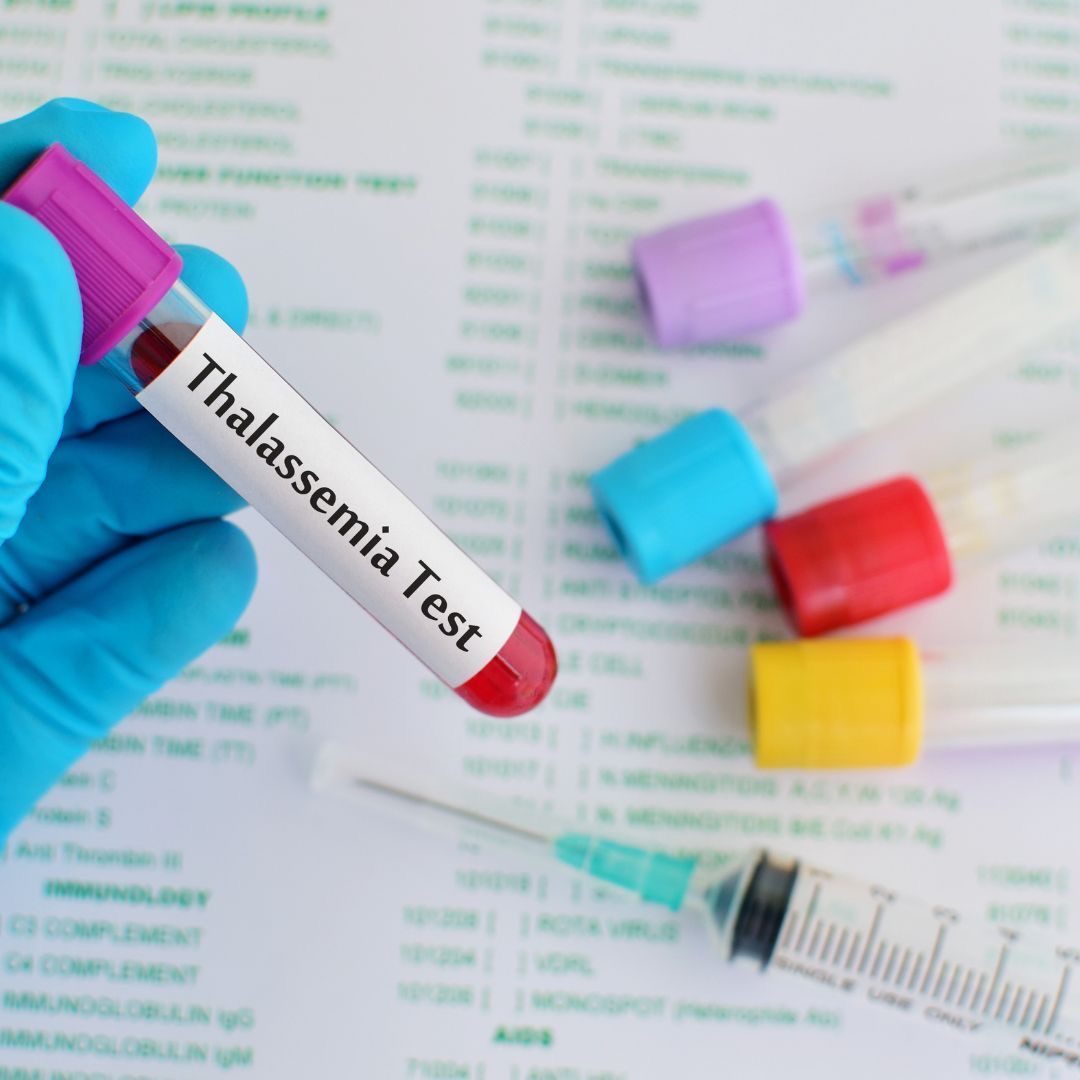 آزمایشگاه ژنتیک نرگس